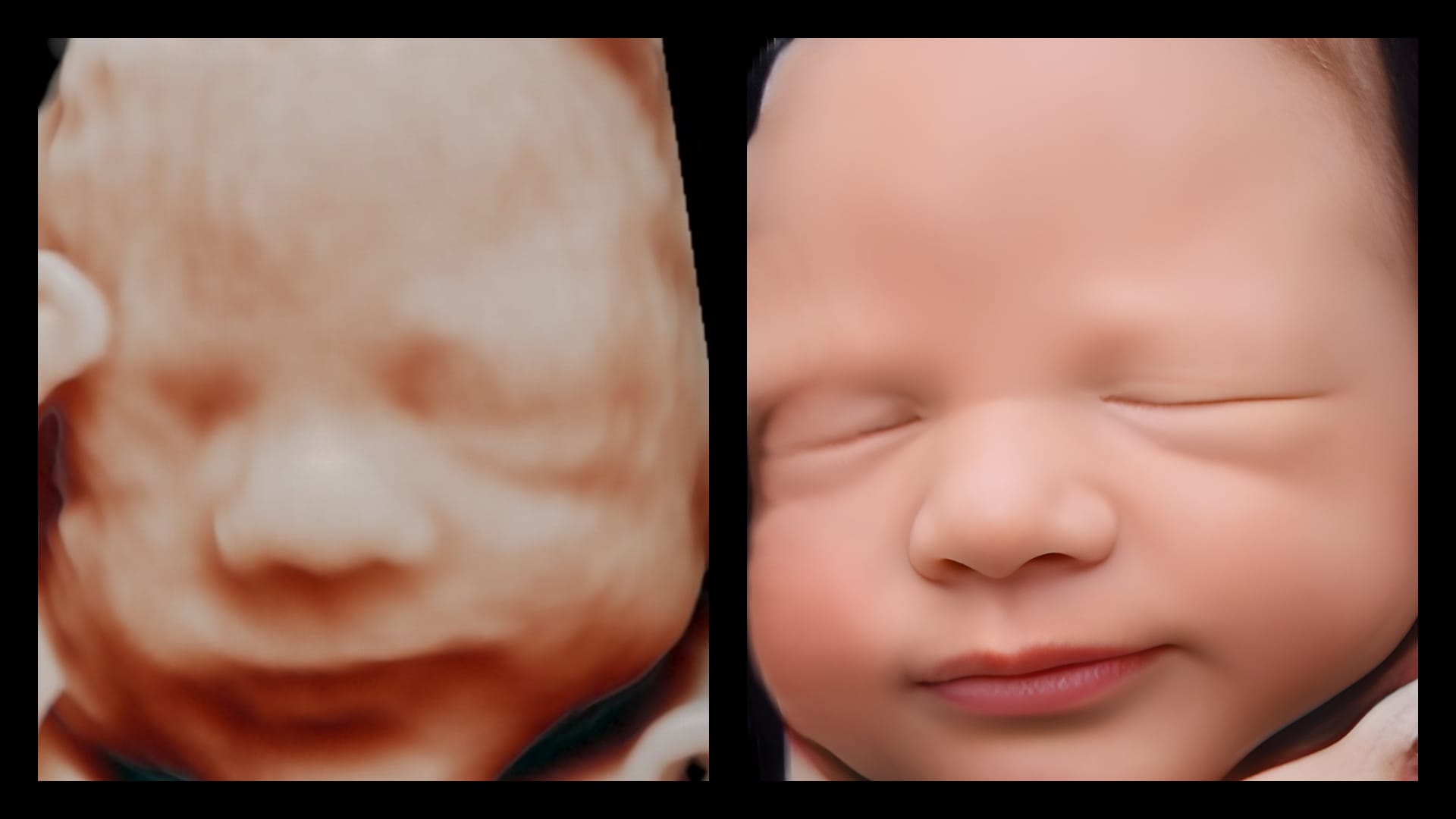 ecografia hiperrealista be·ia comparacion con ecografías 8k / Hyper-realistic Be·ia ultrasound compared to 8K ultrasounds